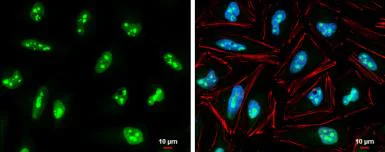 Immunocytochemistry/ Immunofluorescence - Anti-EXOSC5/CML28 antibody (AB154718)