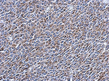 Immunohistochemistry (Formalin/PFA-fixed paraffin-embedded sections) - Anti-EXOSC5/CML28 antibody (AB154718), expandable thumbnail