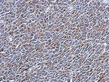 Immunohistochemistry (Formalin/PFA-fixed paraffin-embedded sections) - Anti-EXOSC5/CML28 antibody (AB154718)