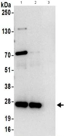 Immunoprecipitation - Anti-EXOSC5/CML28 antibody (AB168804)