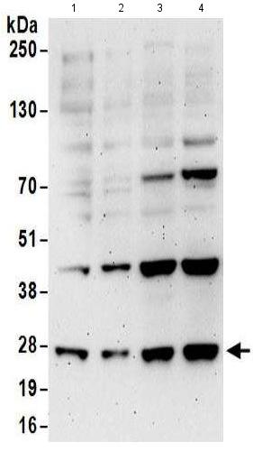 Western blot - Anti-EXOSC5/CML28 antibody (AB168804)