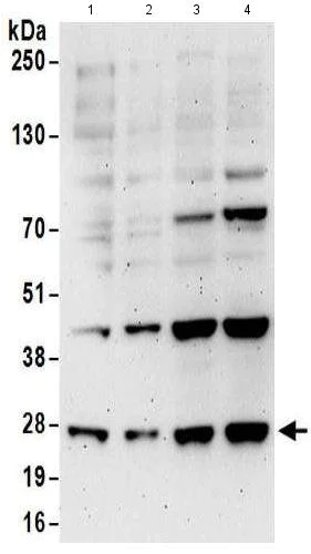 Western blot - Anti-EXOSC5/CML28 antibody (AB168804)