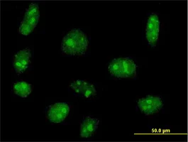 Immunocytochemistry/ Immunofluorescence - Anti-EXOSC5/CML28 antibody (AB69699)