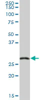 Western blot - Anti-EXOSC5/CML28 antibody (AB69699)