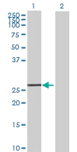 Western blot - Anti-EXOSC5/CML28 antibody (AB69699)
