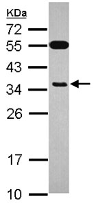 Western blot - Anti-EXOSC8 antibody (AB151584)