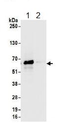 Immunoprecipitation - Anti-EXOSC9 antibody (AB156686)