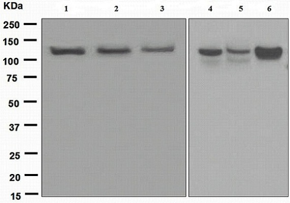 Western blot - Anti-Exportin 4/XPO4 antibody [EPR4442(2)] (AB133237), expandable thumbnail