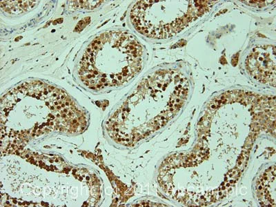 Immunohistochemistry (Formalin/PFA-fixed paraffin-embedded sections) - Anti-Exportin-5 antibody [2C5-1B3] (AB57491)