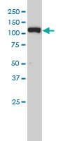 Western blot - Anti-Exportin-5 antibody [2C5-1B3] (AB57491), expandable thumbnail