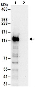Immunoprecipitation - Anti-Exportin-5 antibody (AB168844)