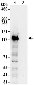 Immunoprecipitation - Anti-Exportin-5 antibody (AB168844)