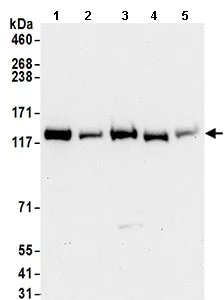 Western blot - Anti-Exportin-5 antibody (AB168844)