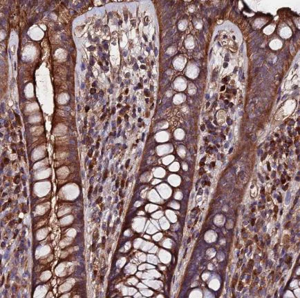 Immunohistochemistry (Formalin/PFA-fixed paraffin-embedded sections) - Anti-Ext1 antibody (AB126305)