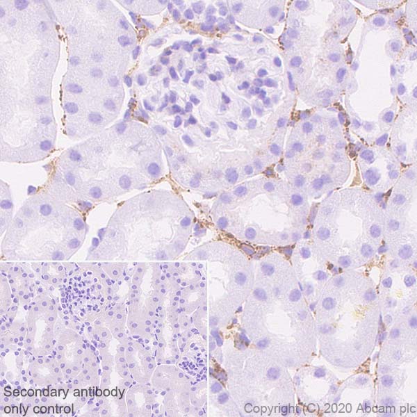 Immunohistochemistry (Formalin/PFA-fixed paraffin-embedded sections) - Anti-Extracellular matrix protein 1 antibody [EPR22411-279] (AB253185), expandable thumbnail