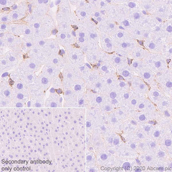 Immunohistochemistry (Formalin/PFA-fixed paraffin-embedded sections) - Anti-Extracellular matrix protein 1 antibody [EPR22411-279] (AB253185), expandable thumbnail