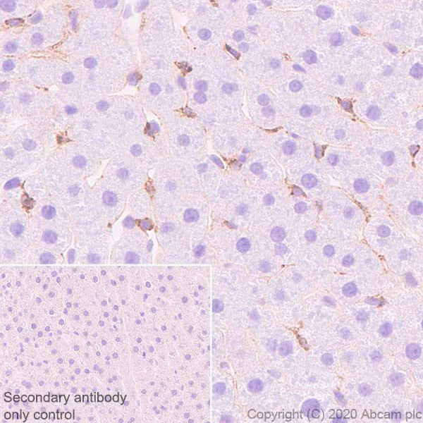 Immunohistochemistry (Formalin/PFA-fixed paraffin-embedded sections) - Anti-Extracellular matrix protein 1 antibody [EPR22411-279] (AB253185)