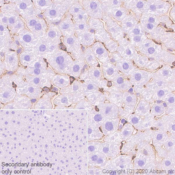 Immunohistochemistry (Formalin/PFA-fixed paraffin-embedded sections) - Anti-Extracellular matrix protein 1 antibody [EPR22411-279] (AB253185), expandable thumbnail