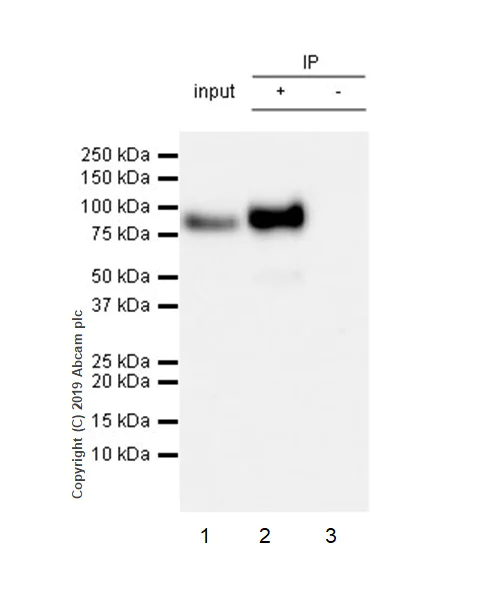 Immunoprecipitation - Anti-Extracellular matrix protein 1 antibody [EPR22411-279] - BSA and Azide free (AB267392)