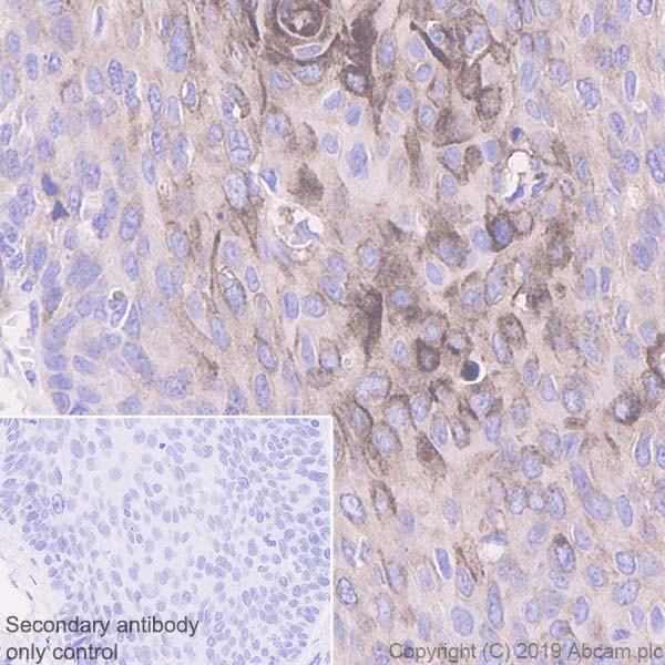 Immunohistochemistry (Formalin/PFA-fixed paraffin-embedded sections) - Anti-Extracellular matrix protein 1 antibody [EPR22434-381] (AB253244), expandable thumbnail