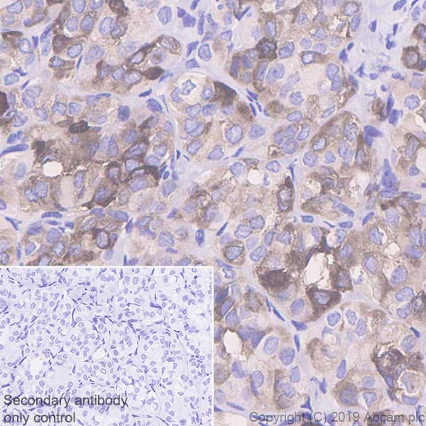 Immunohistochemistry (Formalin/PFA-fixed paraffin-embedded sections) - Anti-Extracellular matrix protein 1 antibody [EPR22434-381] (AB253244), expandable thumbnail