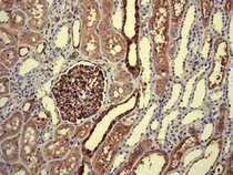 Immunohistochemistry (Formalin/PFA-fixed paraffin-embedded sections) - Anti-Extracellular matrix protein 1 antibody [EPR6701] (AB126629)