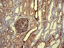 Immunohistochemistry (Formalin/PFA-fixed paraffin-embedded sections) - Anti-Extracellular matrix protein 1 antibody [EPR6701] (AB126629)
