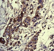 Immunohistochemistry (Formalin/PFA-fixed paraffin-embedded sections) - Anti-Extracellular matrix protein 1 antibody [EPR6701] (AB126629)