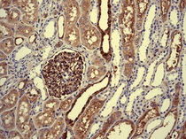 Anti-Extracellular matrix protein 1 antibody [EPR6701]
