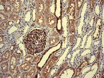 Immunohistochemistry (Formalin/PFA-fixed paraffin-embedded sections) - Anti-Extracellular matrix protein 1 antibody [EPR6701] (AB126629)