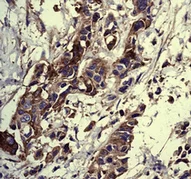 Immunohistochemistry (Formalin/PFA-fixed paraffin-embedded sections) - Anti-Extracellular matrix protein 1 antibody [EPR6701] (AB126629)