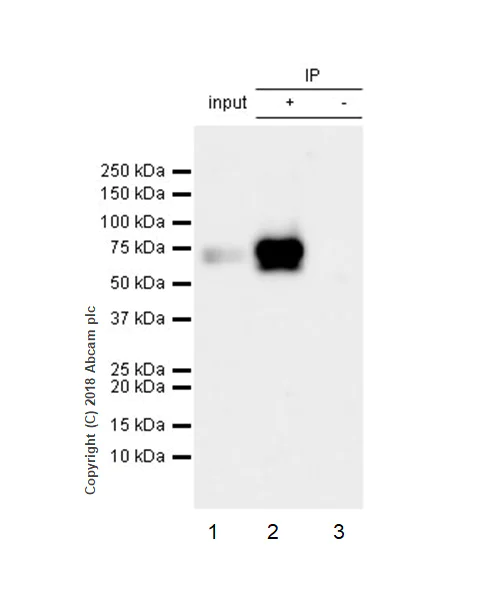 Immunoprecipitation - Anti-Extracellular matrix protein 1 antibody [EPR6701] (AB126629)