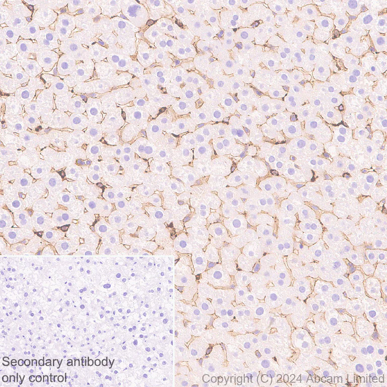 Immunohistochemistry (Formalin/PFA-fixed paraffin-embedded sections) - Anti-Extracellular matrix protein 1 antibody [RM1187] - BSA and Azide free (AB320842)