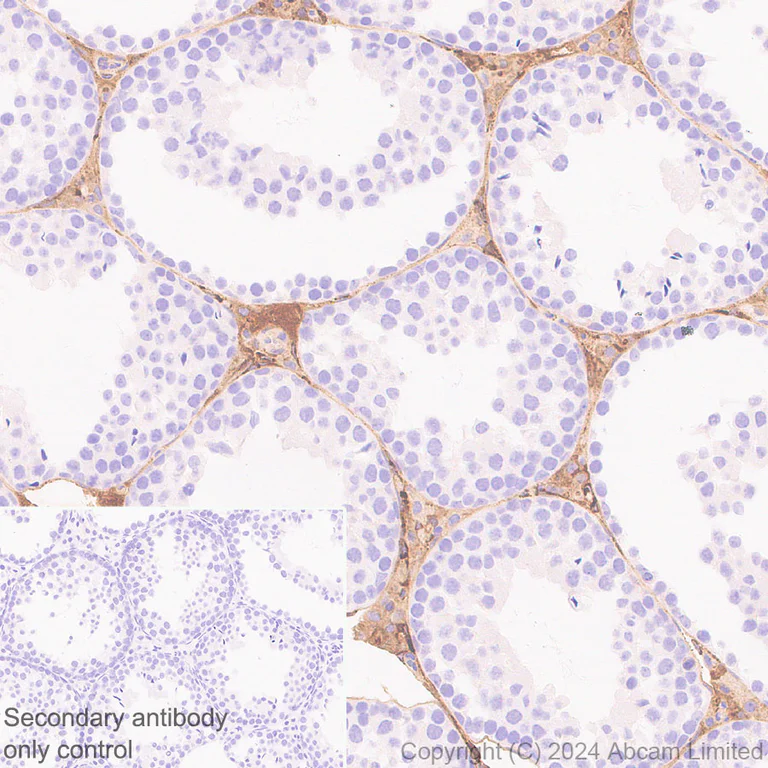 Immunohistochemistry (Formalin/PFA-fixed paraffin-embedded sections) - Anti-Extracellular matrix protein 1 antibody [RM1187] - BSA and Azide free (AB320842)