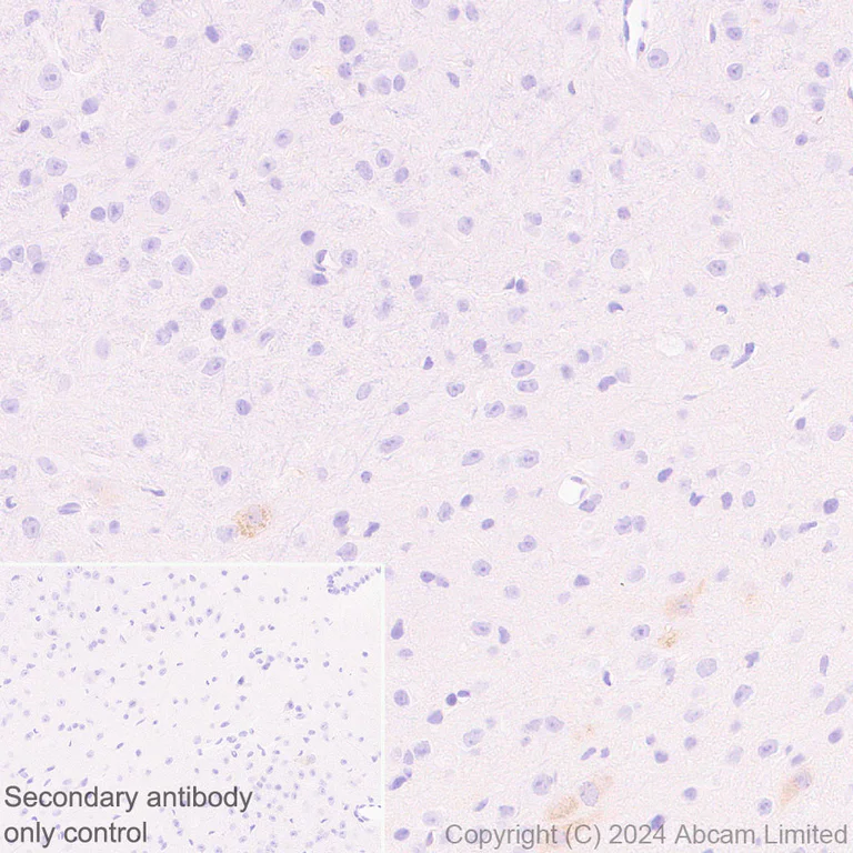 Immunohistochemistry (Formalin/PFA-fixed paraffin-embedded sections) - Anti-Extracellular matrix protein 1 antibody [RM1187] - BSA and Azide free (AB320842)