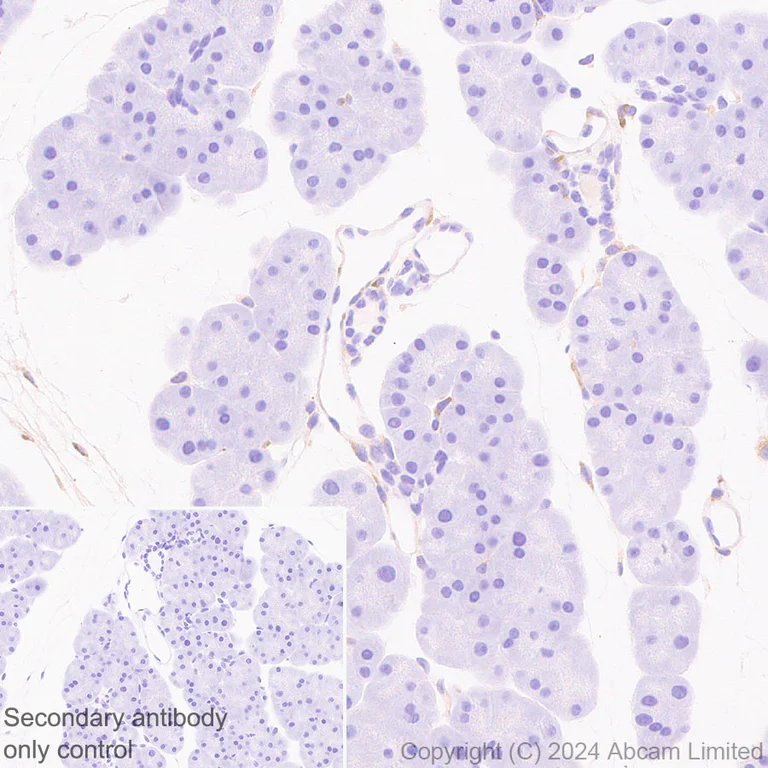 Immunohistochemistry (Formalin/PFA-fixed paraffin-embedded sections) - Anti-Extracellular matrix protein 1 antibody [RM1187] - BSA and Azide free (AB320842)