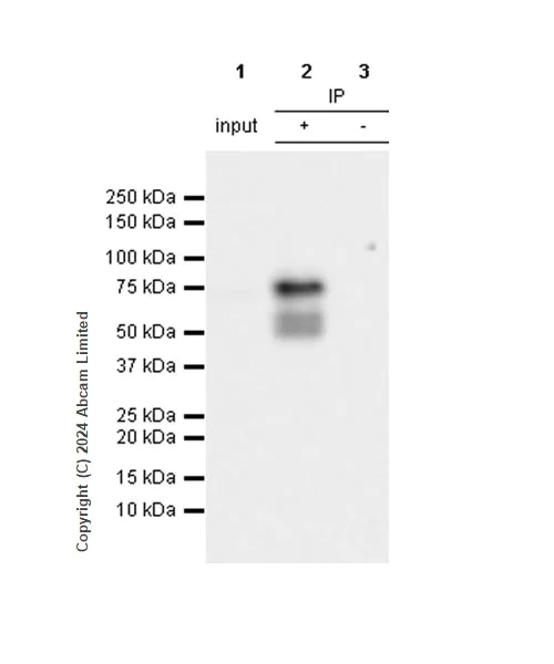 Immunoprecipitation - Anti-Extracellular matrix protein 1 antibody [RM1187] - BSA and Azide free (AB320842)