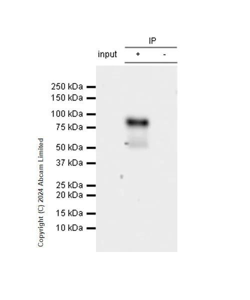 Immunoprecipitation - Anti-Extracellular matrix protein 1 antibody [RM1187] - BSA and Azide free (AB320842)