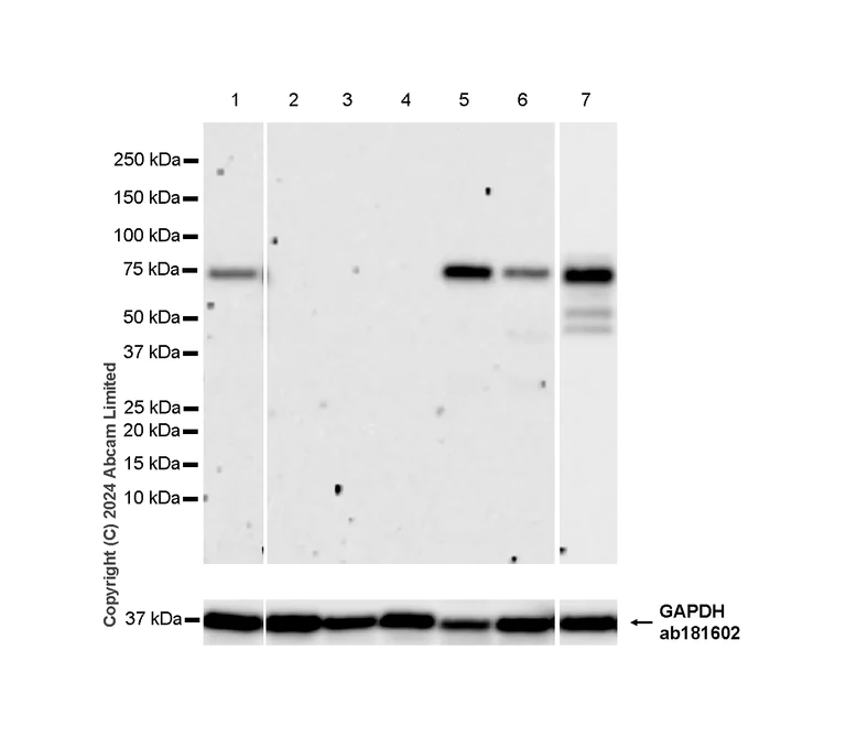Western blot - Anti-Extracellular matrix protein 1 antibody [RM1187] - BSA and Azide free (AB320842)