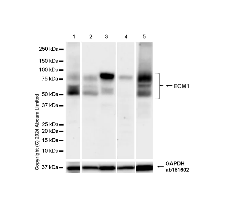 Western blot - Anti-Extracellular matrix protein 1 antibody [RM1187] - BSA and Azide free (AB320842)