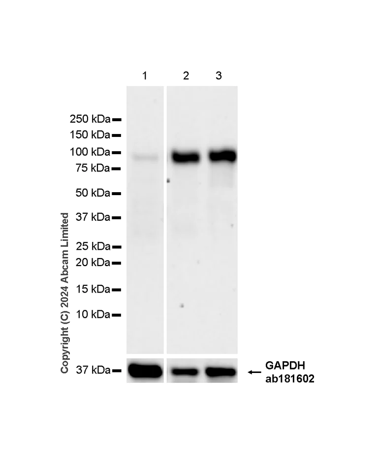 Western blot - Anti-Extracellular matrix protein 1 antibody [RM1187] - BSA and Azide free (AB320842)