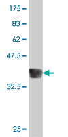 Western blot - Anti-EYA1 antibody (AB194448)