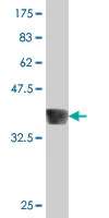 Western blot - Anti-EYA1 antibody (AB194448)