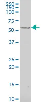 Western blot - Anti-EYA1 antibody (AB194448)
