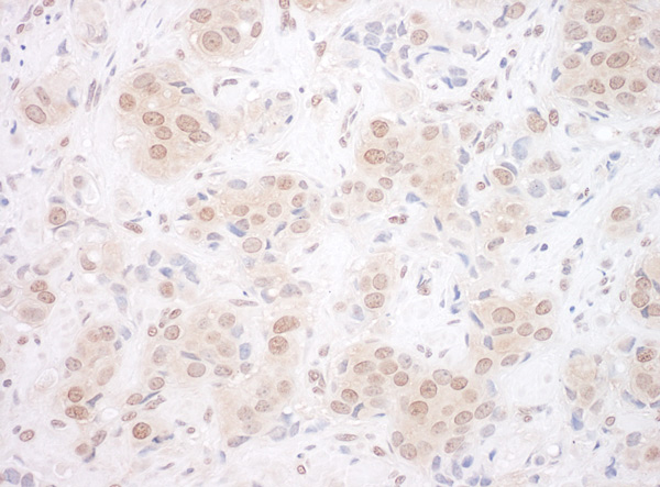 Immunohistochemistry (Formalin/PFA-fixed paraffin-embedded sections) - Anti-EYA3 antibody (AB95876), expandable thumbnail