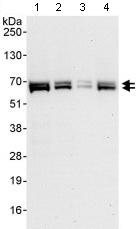 Western blot - Anti-EYA3 antibody (AB95876), expandable thumbnail