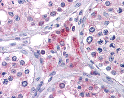 Immunohistochemistry (Formalin/PFA-fixed paraffin-embedded sections) - Anti-EYA4 antibody (AB110148)