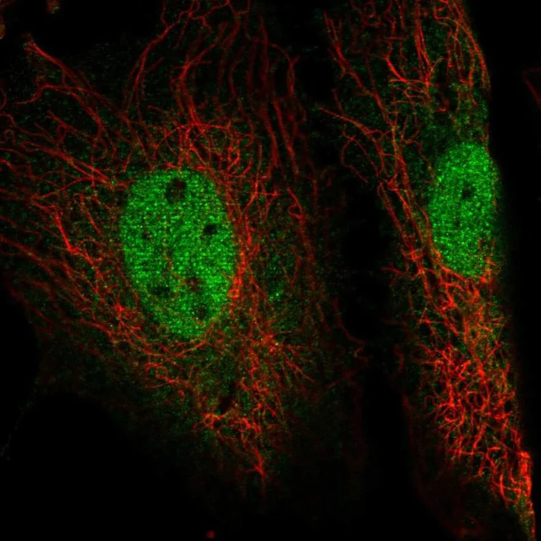 Immunocytochemistry/ Immunofluorescence - Anti-EYA4 antibody (AB251675)