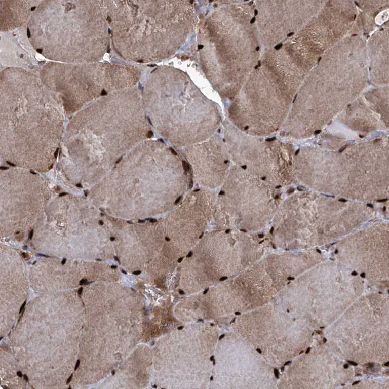 Immunohistochemistry (Formalin/PFA-fixed paraffin-embedded sections) - Anti-EYA4 antibody (AB251675)