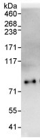 Immunoprecipitation - Anti-EYA4 antibody (AB93865)